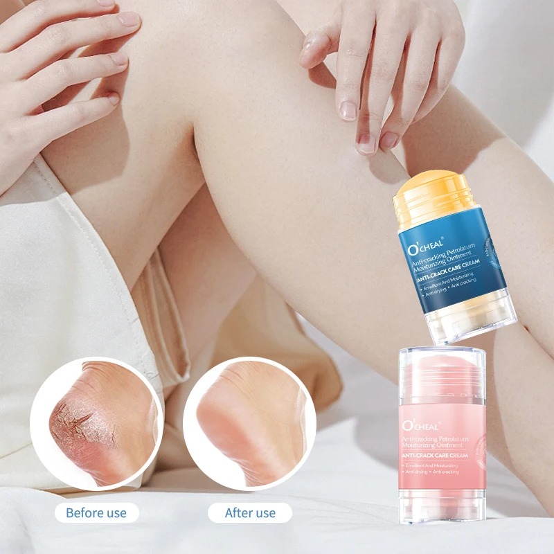 Anti Crack Foot Cream For Dry  - Heels 评论和价格